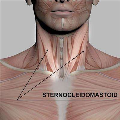 Sternocleidomastoid Pain? Remedies and Treatment to Relieve Pain